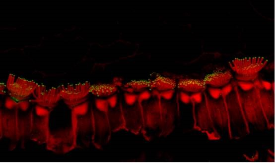 Enhanced microscopic image showing hair-like projections (stereocilia) on the sensory hair cells in the inner ear of a mouse model treated with inner ear gene therapy. The mouse has a genetic form of deafness that causes the stereocilia to be short and defective. Gene therapy elongated the stereocilia and improved hearing.