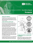Ronquera (Hoarseness)