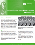Otosclerosis