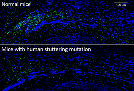 Top panel: A microscopic image of normal mouse brain cells stained in blue. Cells shown in green are astrocytes, a type of support cell in the brain.
Bottom panel: A microscopic image showing many fewer green-stained astrocytes in mice engineered with a human stuttering gene.