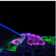 Sensory hair cells in the inner ear.