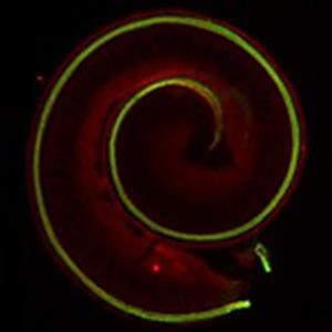 Cochlea