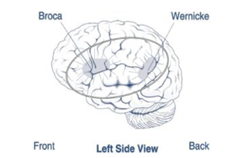 Brain diagram with language and speech areas labeled